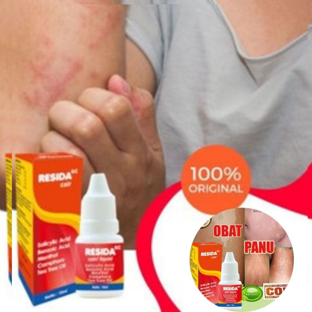 Salep Panu Paling Ampuh 100% Obat Panu Cair Kurap Kadas Gatal Selangkangan Jamur Kulit Hapur Exim