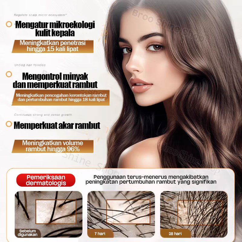 Serum Rambut Roller Minyak Penumbuh Rambut Cepat Pelebat Rambut Pertumbuhan Rambut Hair Oil Rosemary