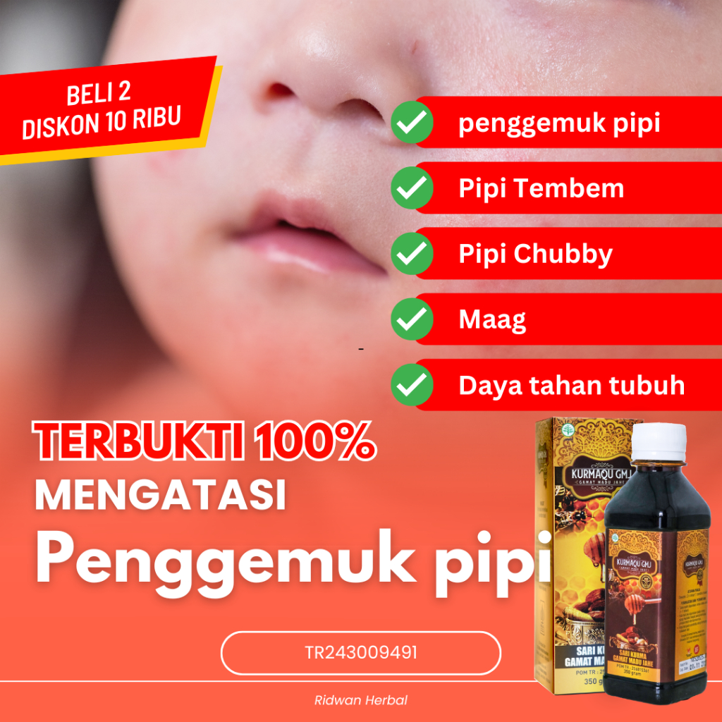 Obat Penggemuk Pipi Cabi, Obat penggemuk pipi, Pipi Tembem, Pipi TembemPipi Tembem,Obat Penggemuk Pi