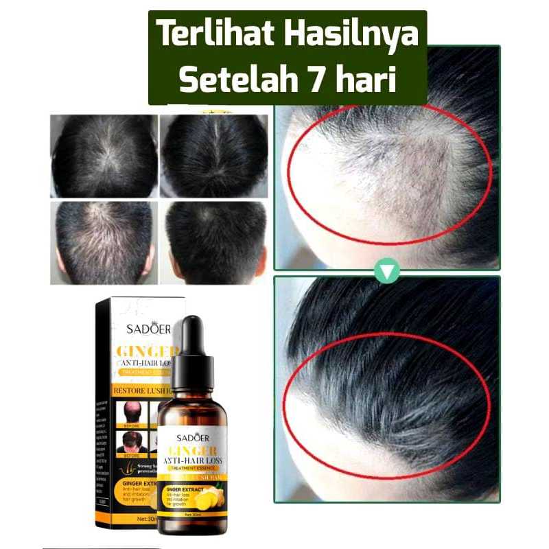 302 Serum Penumbuh Rambut Ginger Germinal Oil GINGER KING OIL Clothes of Skin Ginger Germinal Oil