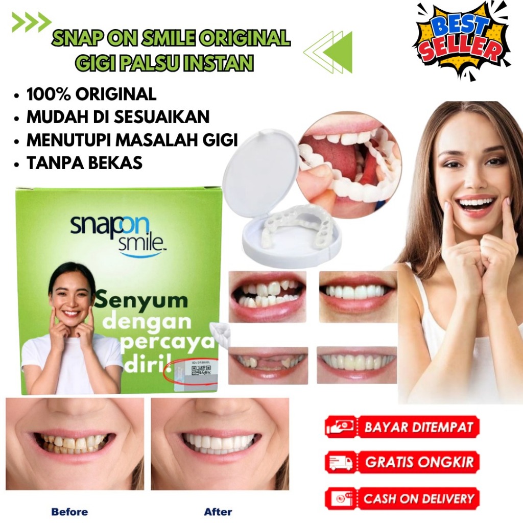 Snap On Smile Garansi Original 100% Original - Gigi Palsu Instan Atas Bawah Untuk Ompong - Lem Gigi 