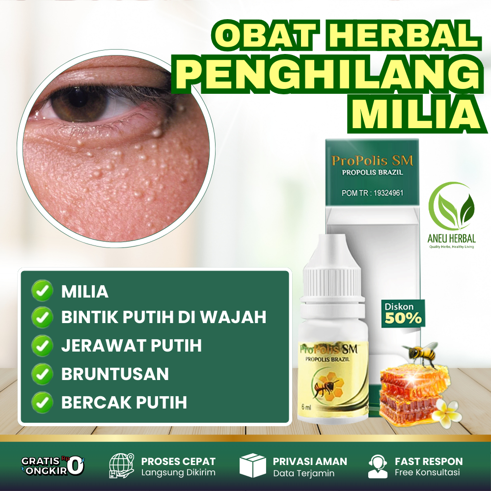 Propolis SM Obat Tetes Penghiliang Milia Penghilang Bintik Putih Penghilang Jerawat Putih Penghilang