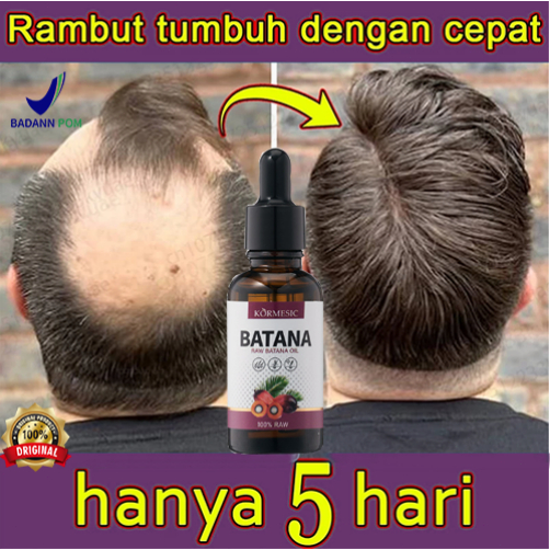[Anti Rambut Rontok] Minyak Rambut Perawatan Rambut Rusak Dalam Minyak rambut mencegah rambut rontok
