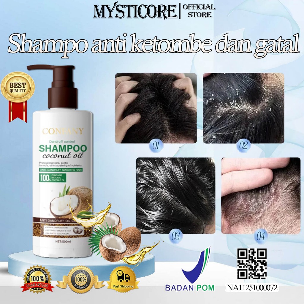 Shampoo anti dandruff Shampoo psoriasis kulit kepala Shampoo Anti Ketombe dan rontok Shampo Menghila
