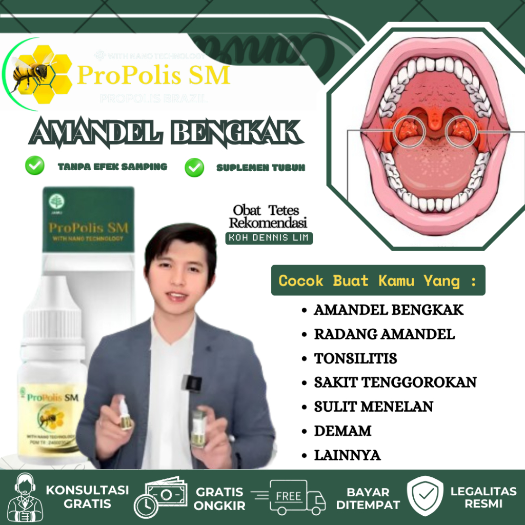 Obat Amandel Bengkak Tonsilitis Radang Amandel Sakit Tenggorokan Mengempeskan Amandel Bengkak Anak D