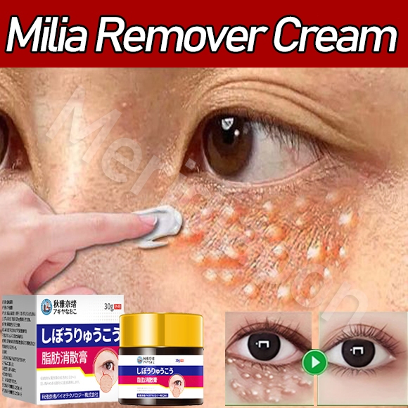 Krim penghilang milia Obat milia di wajah Salep Milia Di Bawah Mata Milia remover cream original Kri