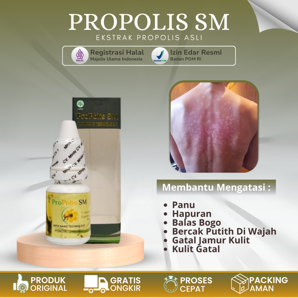 [COD] Obat Oles Penghilang Panu, Obat Panu Cair, Obat Panu Di Wajah / Leher / Punggung / Dada, Obat 