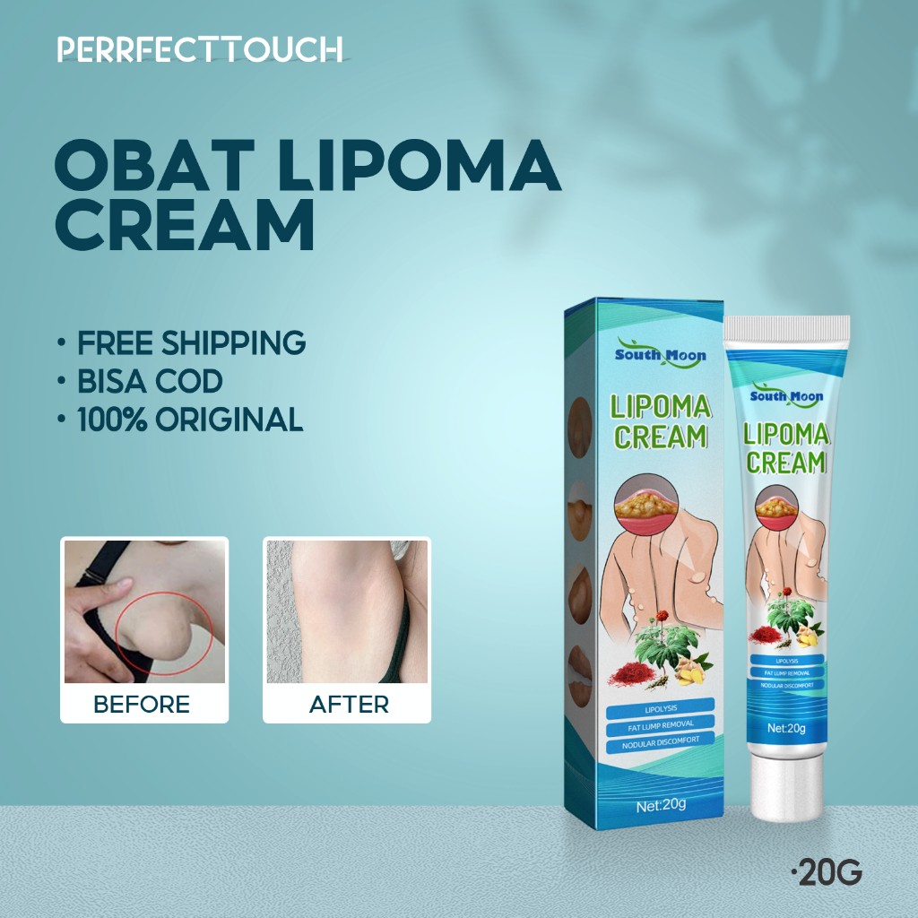 South Moon Obat Lipoma Cream 20g Obat Payudara Benjolan Lipoma Removal Cream Original Salep Benjolan