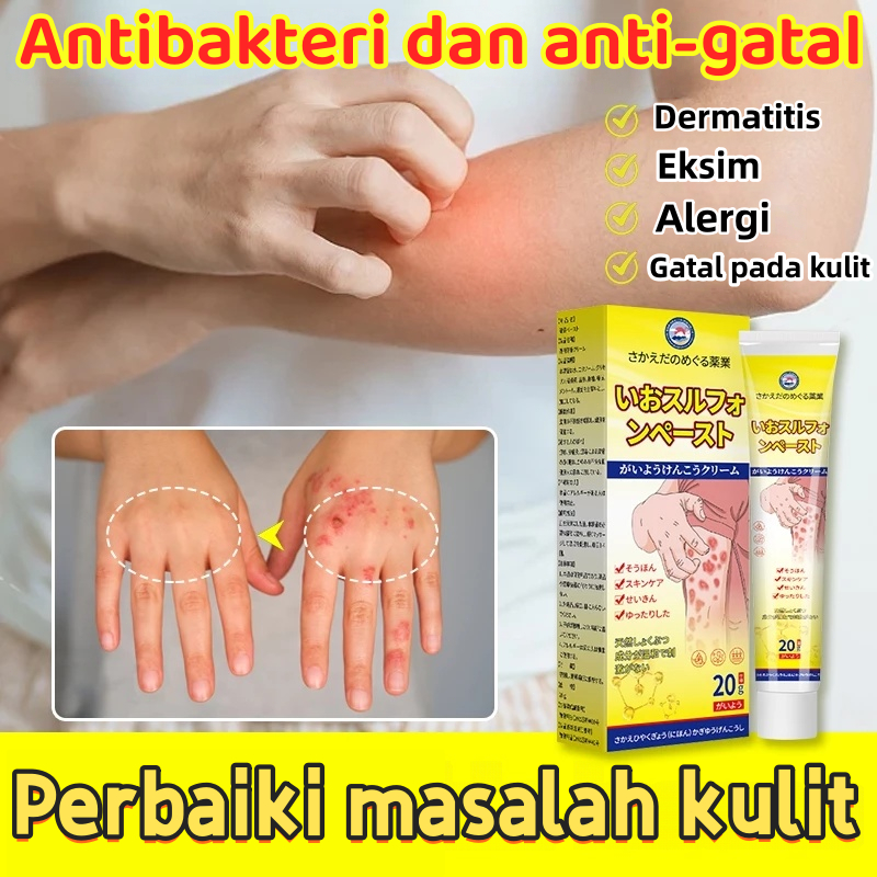 Salep Belerang Jepang untuk Psoriasis dan Krim Antipruritik Herbal Cina Antibakteri untuk Meredakan 