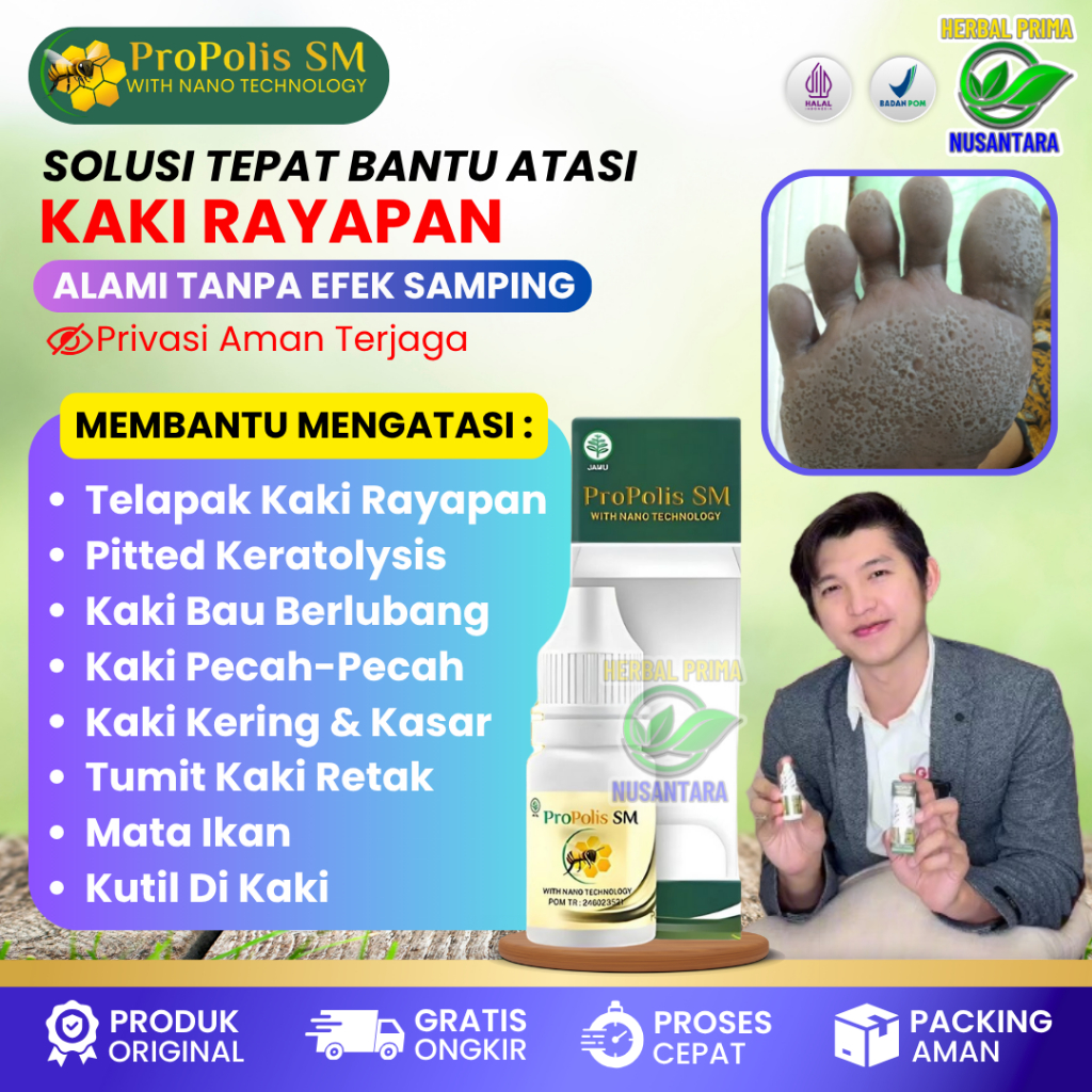 Obat Tetes Telapak Kaki Berlubang Kecil Kecil - Obat Kaki Rayapan - Obat Telapak Kaki Bolong Bolong 