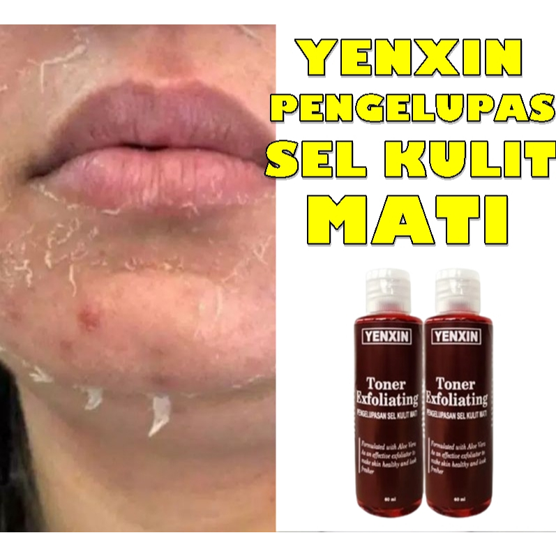 2 BOTOL TONER PELUPAS KULIT WAJAH - EXFOLIATING YENXIN PENGELUPASAN SEL KULIT MATI WAJAH DALAM 5 MEN