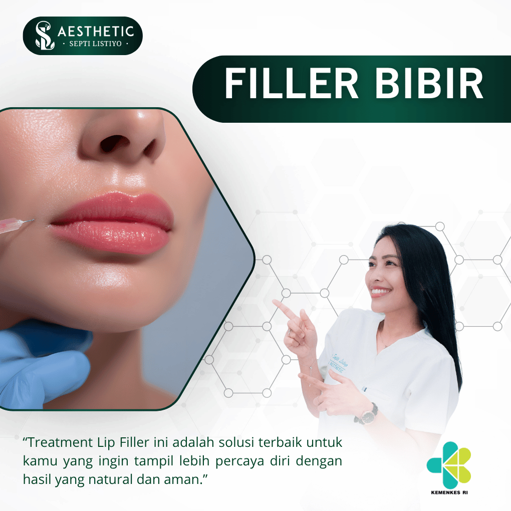 E - Voucer Lip Filler Aman & Natural | Filler Bibir oleh Dokter Estetika | Kecantikan Terpercaya