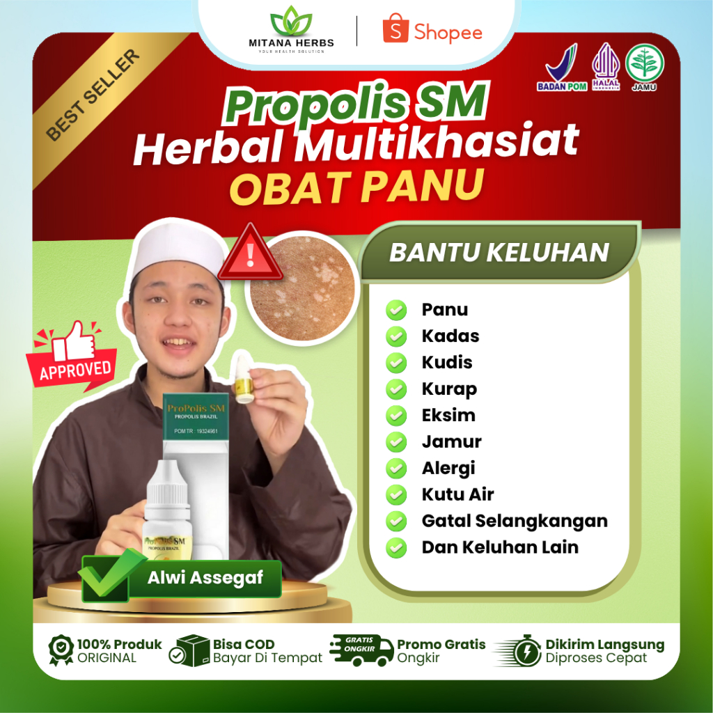 Propolis SM Obat Panu Anak dan Dewasa, Obat Panu Cair, Obat Jamur Kulit, Obat Penghilang Panu Kadas 