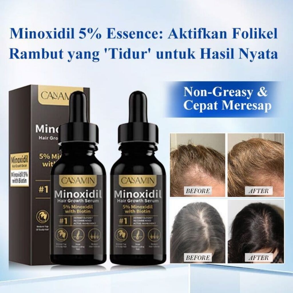 [100%original] Serum Minoxidil 5% with Biotin -Serum Minoxidil penumbuh rambut cepat dan mencegah ra