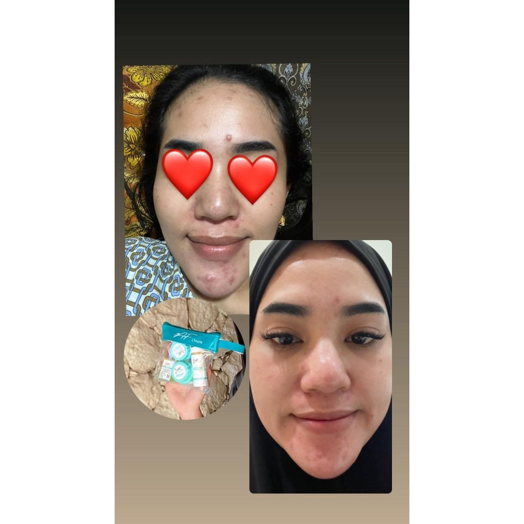 AF CREAM DOUBLE GLOW