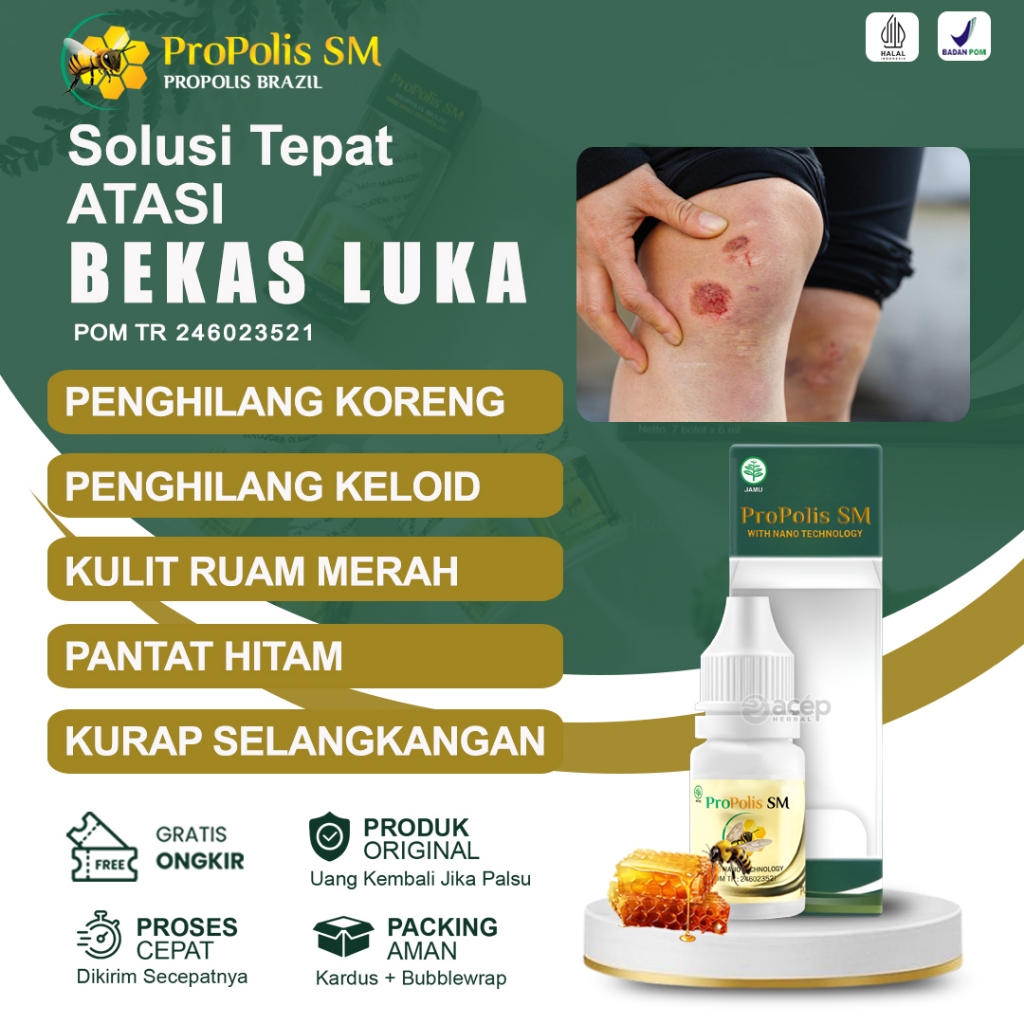 Obat Penghilang Bekas Luka Koreng Di Kaki Keloid Daging Tumbuh Pemutih Pantat Bokong Hitam Gatal Sel