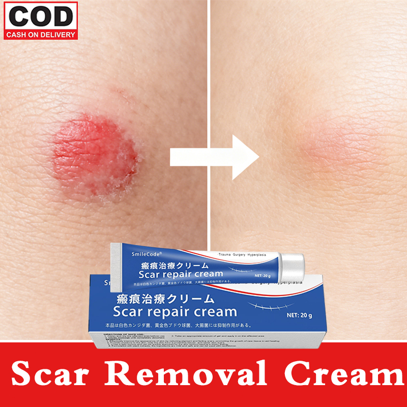 Salep penghilang bekas luka Penghilang bekas luka hitam koreng Penghilang bekas luka di kaki Penghil