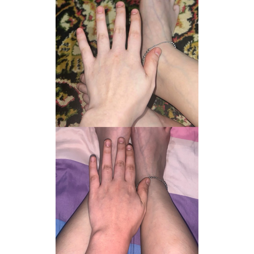 HB DOSTING KULIT BADAK/SUSAH PUTIH