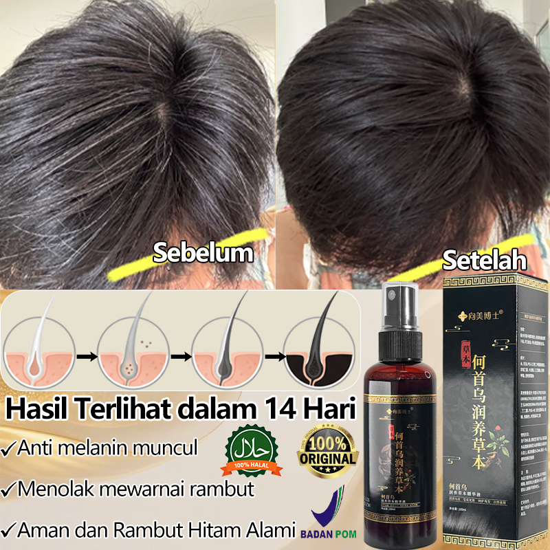Penghitam rambut uban permanen Penumbuh rambut cepat dan tebal Penghilang uban paling ampuh 100ml Se