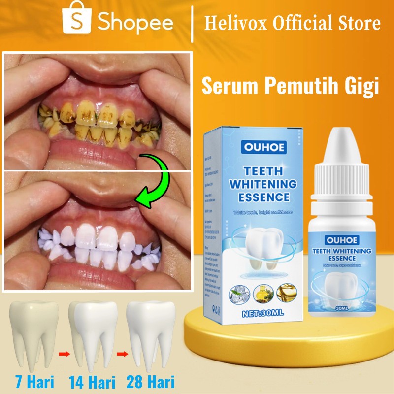 HELIVOX Pembersih gigi kuning Pemutih gigi Perontok karang gigi dan plak Pembersih karang gigi berke