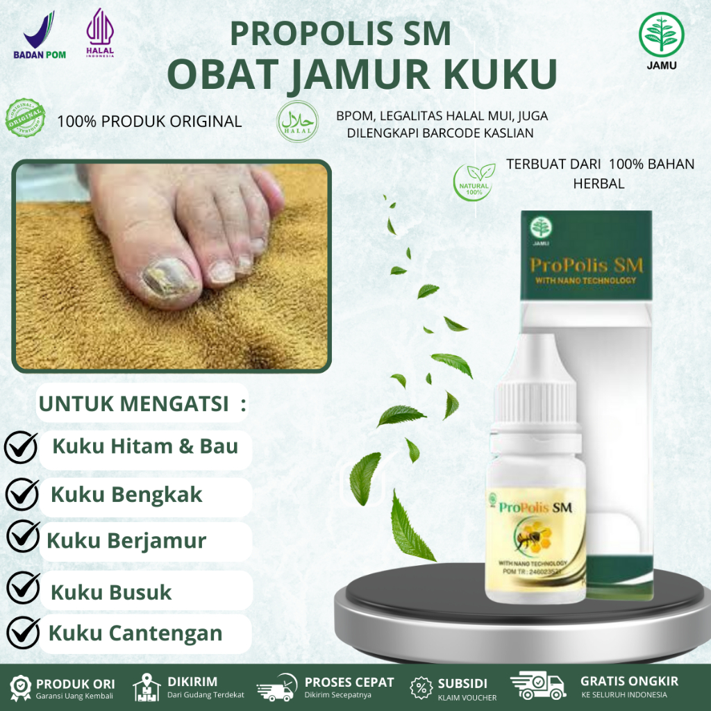 Obat kuku rusak, kuku jamuran, Kuku Busuk Dan Hitam , Cantengan Jempol Kaki
