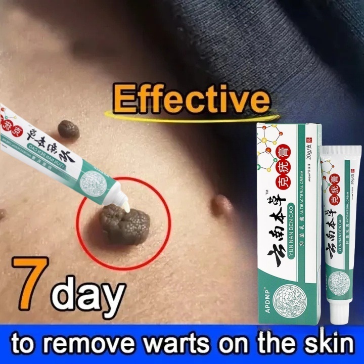 Obat kutil ampuh ori Penghilang Kutil Dan Tahi Lalat Penghilang Skin Tag Remover Obat Kutil Di Leher