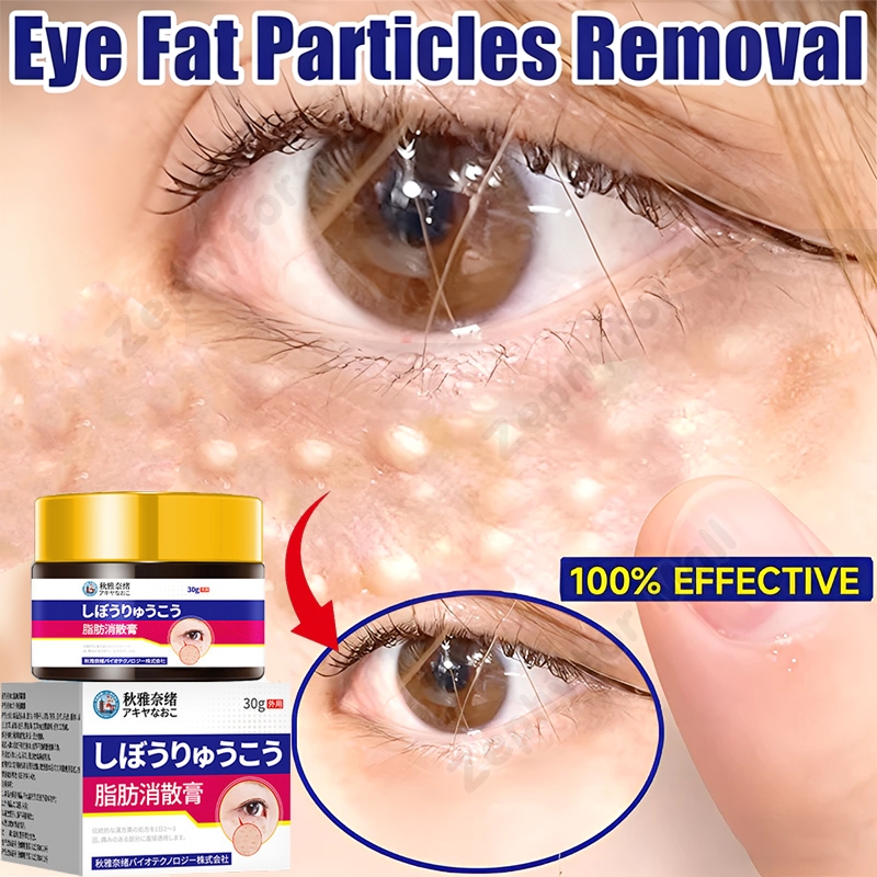 penghilang milia paling ampuh 30g obat milia salep milia penghilang milia di bawah mata syringoma xa