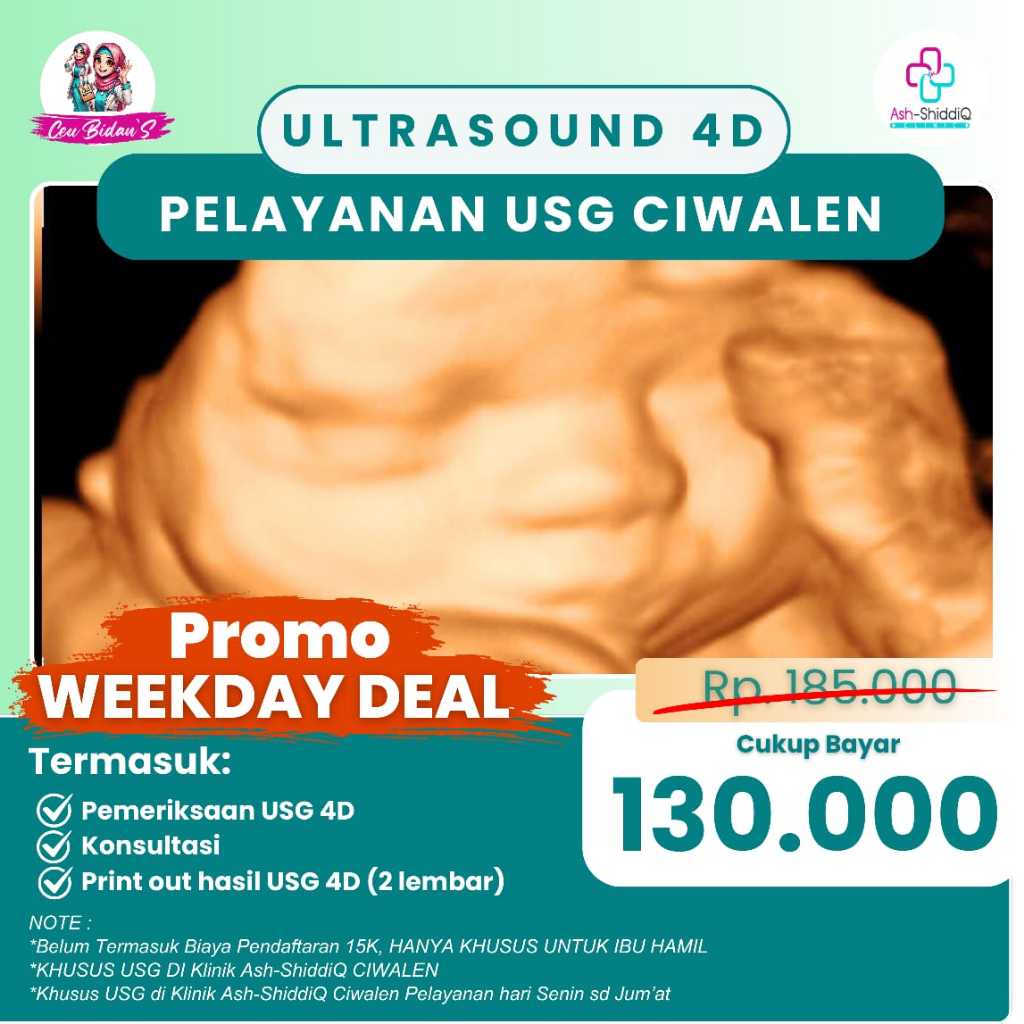 USG 4D PROMO WEEKDAY DESEMBER- Best Deal, Print Out hasil USG 4D (2), Konsultasi, Pemeriksaan USG 4D
