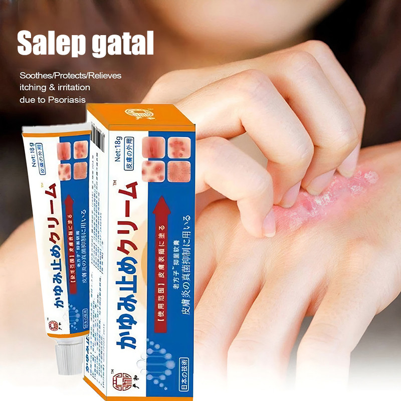 Salep Gatal Salep Eksim Salep Kulit Krim Psoriasis Paling Ampuh 20g Kulit Kepala Anti Jamur