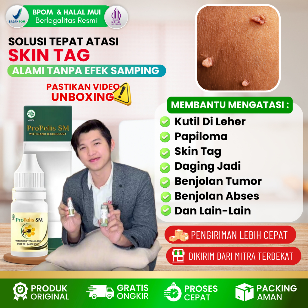 PROPOLIS SM - Obat Tetes Oles Penumpas Skin Tag di Leher, Skin Tag, Obat Penghilang Skin Tag, Papill
