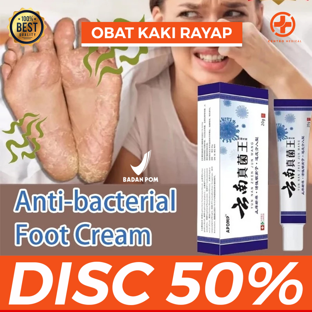 [PROMO] Obat Salep Kutu Air / Salep Kaki Rayapan / Salep Kaki Pecah - Pecah Kaki Bolong - Bolong ORI