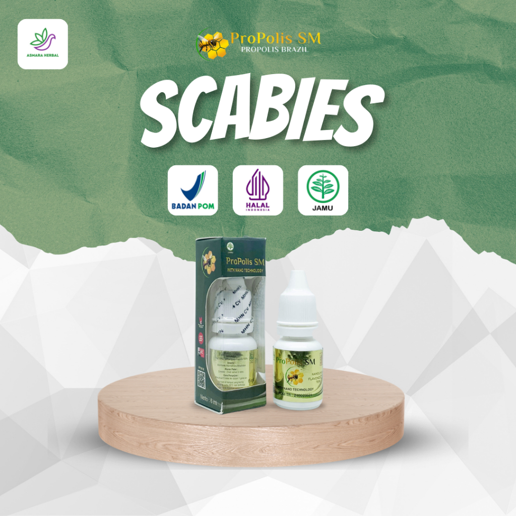 Obat Oles Scabies, Skabies, Kudis, Gudik - Propolis SM - BPOM dan Halal MUI