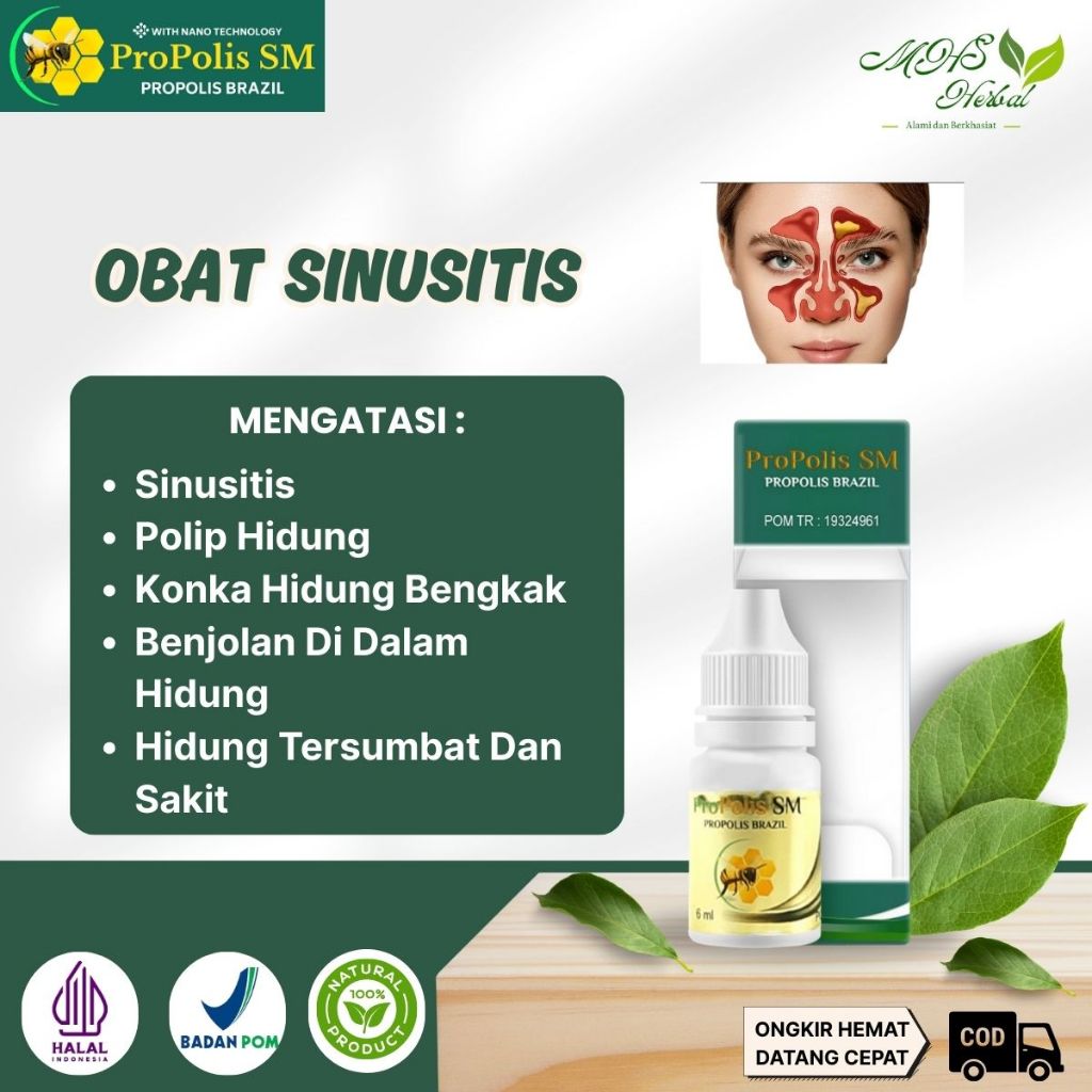 Obat Sinusitis, Hidung Tersumbat, Polip Hidung, Konka Hidung Bengkak, Benjolan Di Dalam Hidung, Rhin