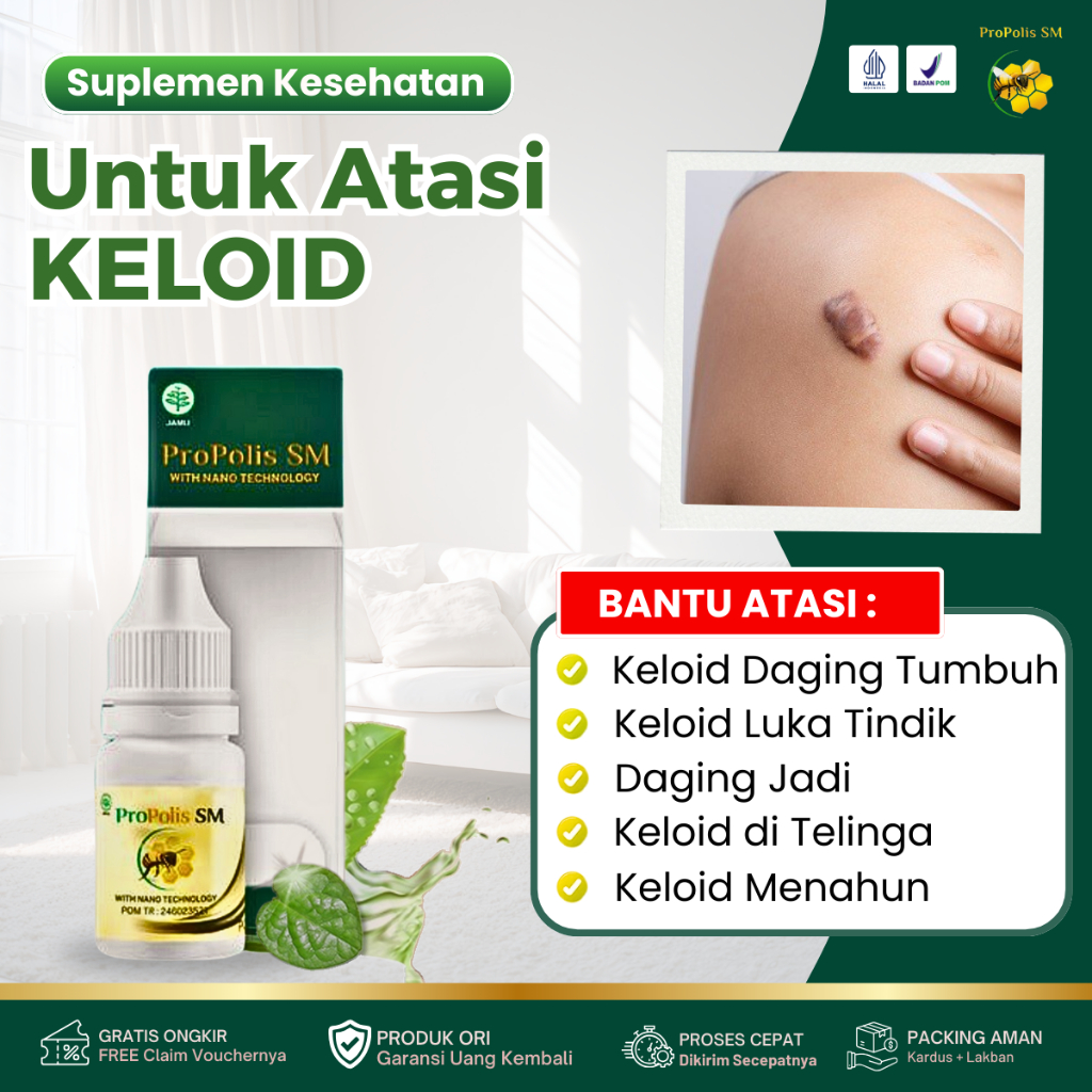 Obat Penghilang Keloid, Keloid di Telinga, Keloid Berkerut, Keloid Daging Tumbuh, Keloid Bekas Luka,