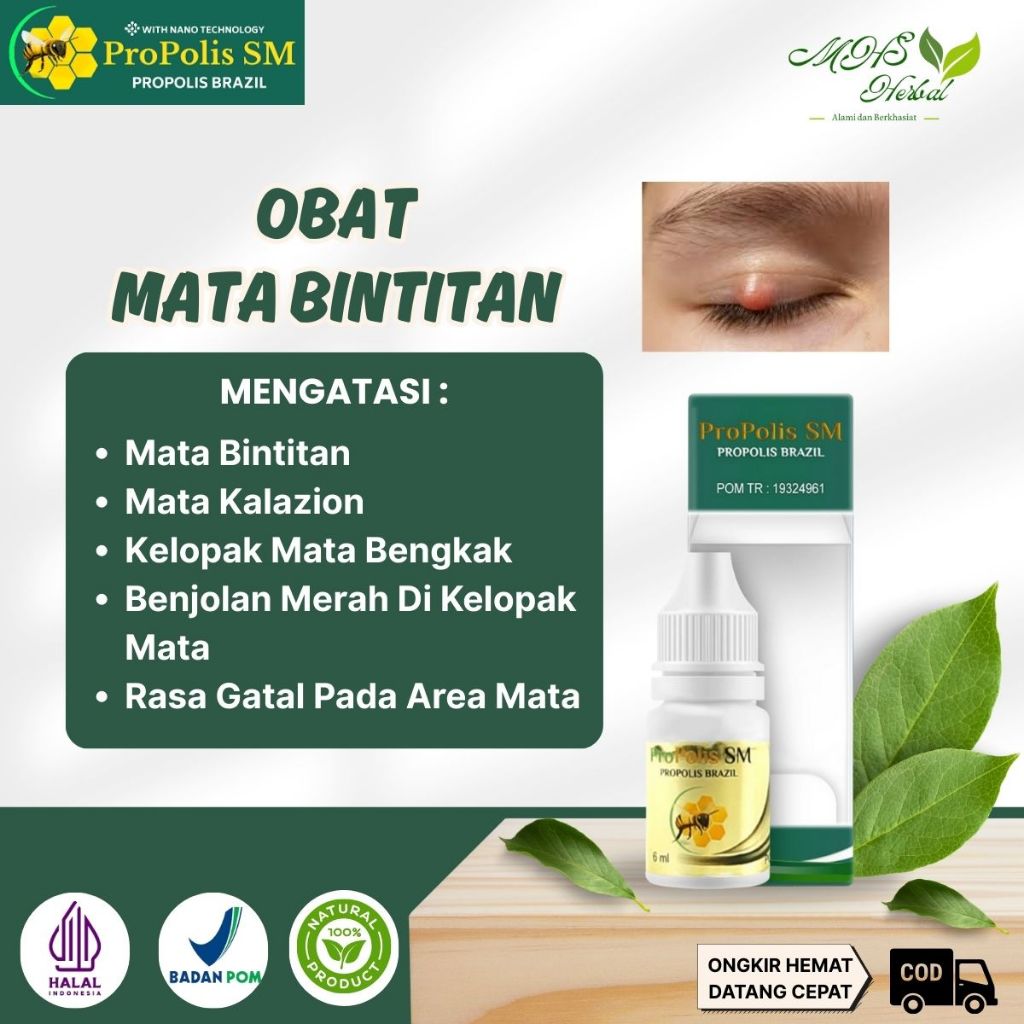 Obat Mata Bintitan, Kelopak Mata Bengkak, Mata Kalazion, Penghilang Benjolan Di Kelopak Mata, Benjol