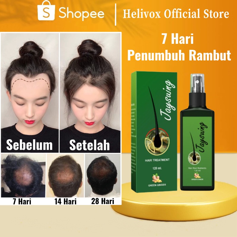 HELIVOX Hair serum rambut rontok Penumbuh rambut botak Pelebat rambut Serum penebal rambut Tumbuh ra