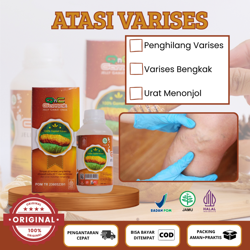 Obat Penghilang Varises, Masalah Varises Di kaki & Tangan, Varises Membengkak, Urat Menonjol-QnC jel