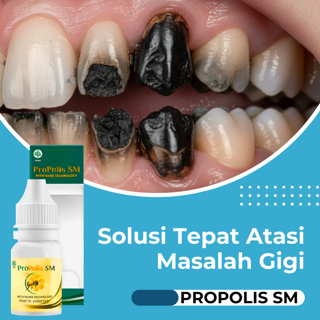 Obat Penghancur Gigi Berlubang - Perontok Gigi Hitam - Obat Sakit Gigi Berlubang - Penghilang Bau Mu