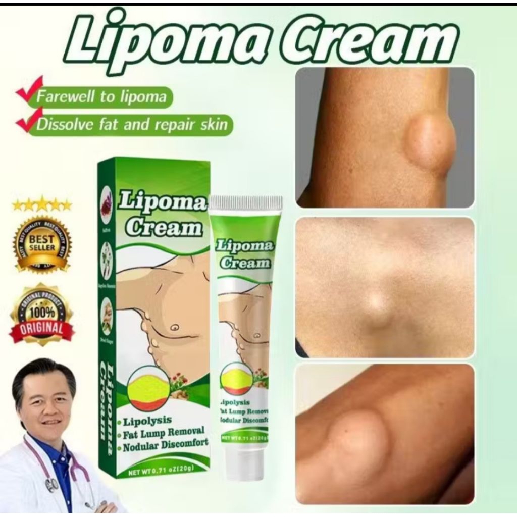 SALEP LIPOMA KRIM SALEP BENJOLAN KRIM PENGHILANG LIPOMA REMOVAL LIPOMA 100% AMPUH UNTUK BENJOLAN LIP