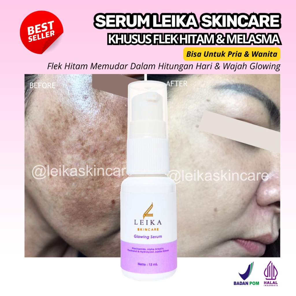 Serum Leika Skincare Penghilang Flek Hitam di wajah BPOM Menghilangkan Flek Hitam Original Penghilan