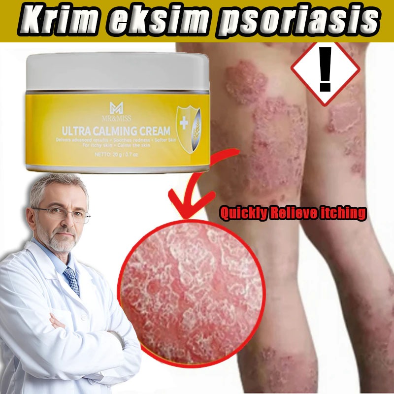 Obat kurap Obat gatal selangkangan Salep gatal china paling ampuh Salep gatal eksim paling ampuh sal