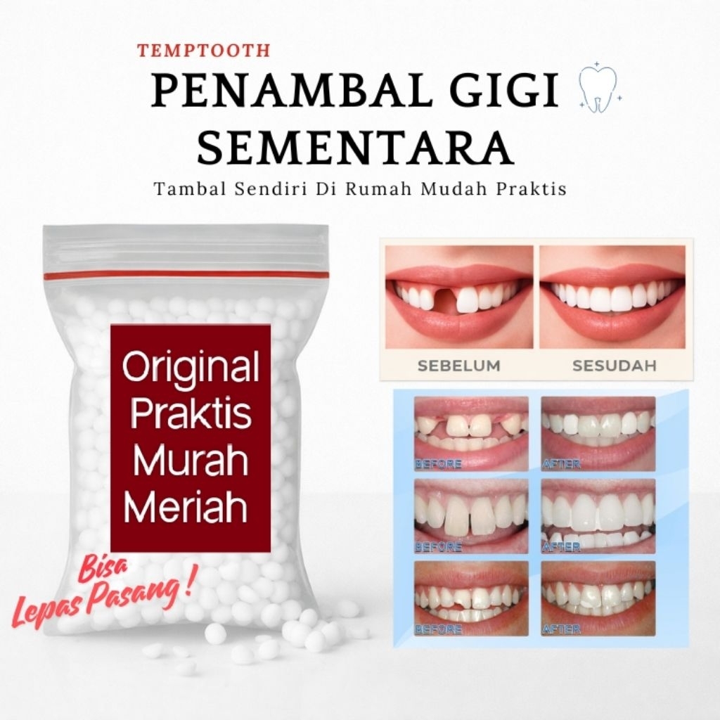 Penambal Gigi Temptooth Murah 100 Butir Original