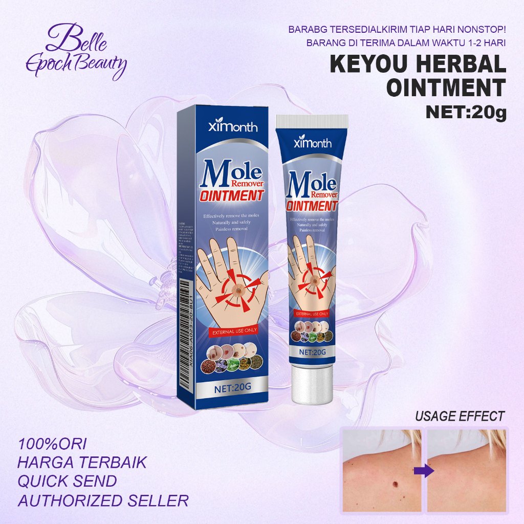 Ximonth Salep Penghilang Tahi Lalat Dan Kutil 20g - Krim Penghilang Kutil Krim Penghilang Kutil Waja