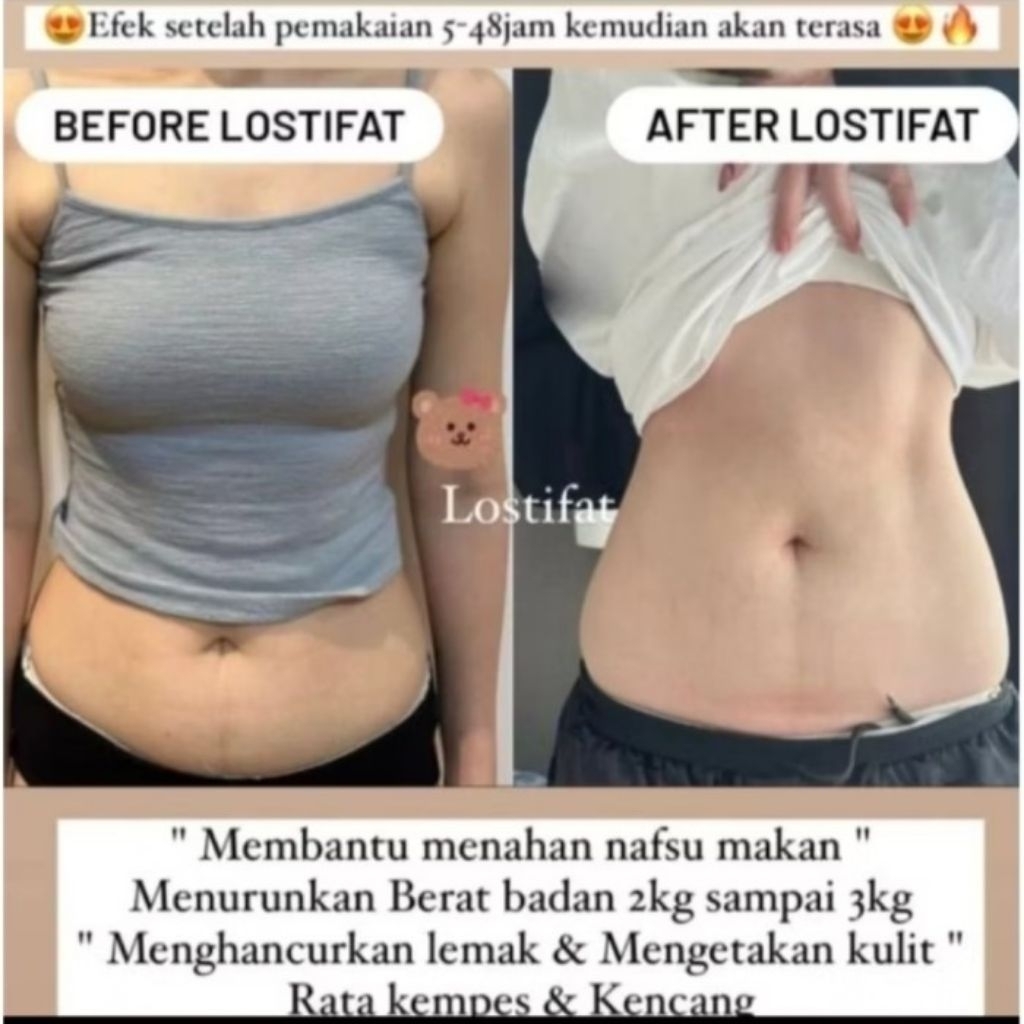 Lostifat Retail Triple Strong Dose