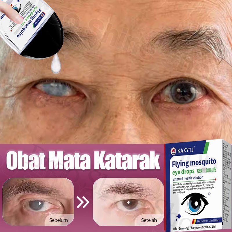 Obat Tetes Mata Obat Mata Katarak Obat Mata Minus Tetes Mata Lutein Kering/Merah/Buram Fresh Vision 