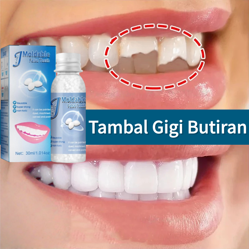 Tambal gigi Penambal gigi berlubang Lem gigi Butiran penambal gigi Tambal Gigi Permanen Super Kuat B