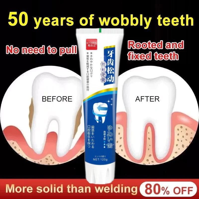 Pasta Gigi Khusus Untuk Memperbaiki Gigi Goyang Gusi Bengkak Dan Nyeri Sakit Gigi Gigi Gemetar Pence