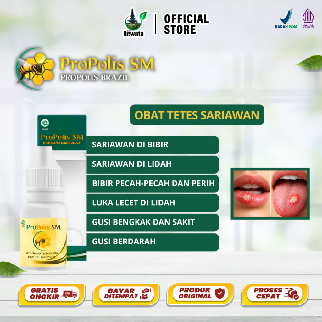 Obat Sariawan Di Bibir Dan Lidah Atasi Bau Mulut Bibir Kering Dan Pecah Pecah Panas Dalam Lidah Berj