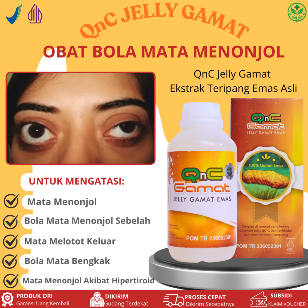 Obat Mata Menonjol Akibat Hipertiroid, Bola Mata Keluar, Mata Menonjol Sebelah Kiri / Kanan, Bola Ma