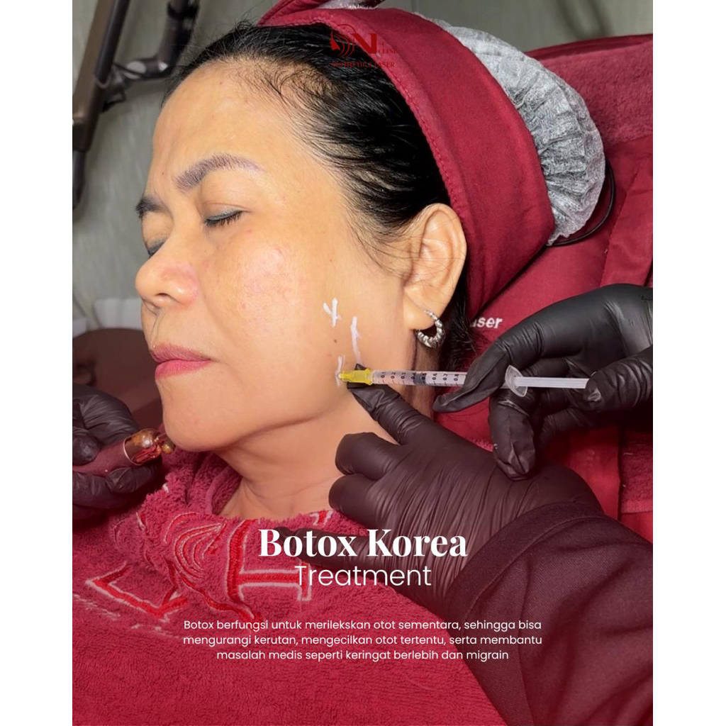 [Vocher] DNF BOTOX 100 unit